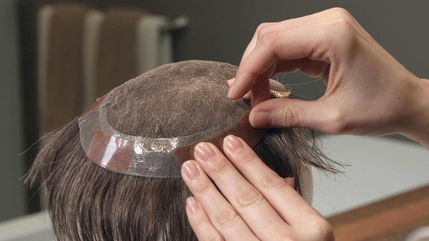Psoriasis Treatment